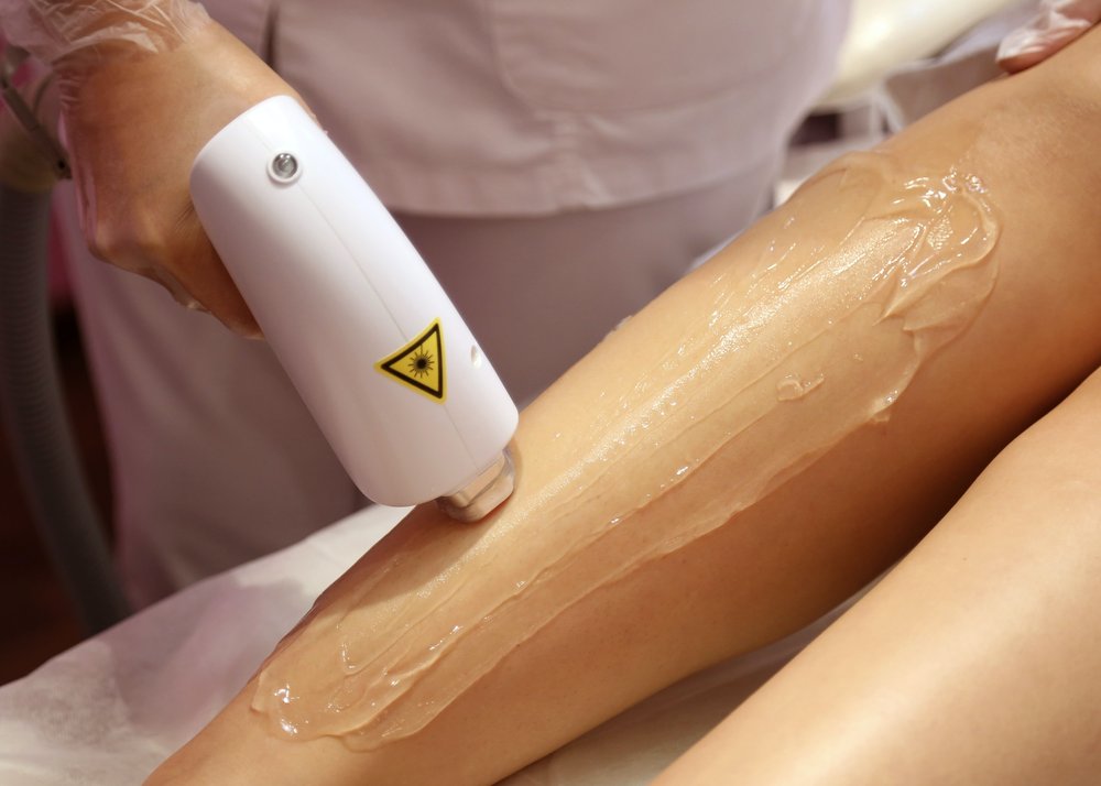 Laser hair removal